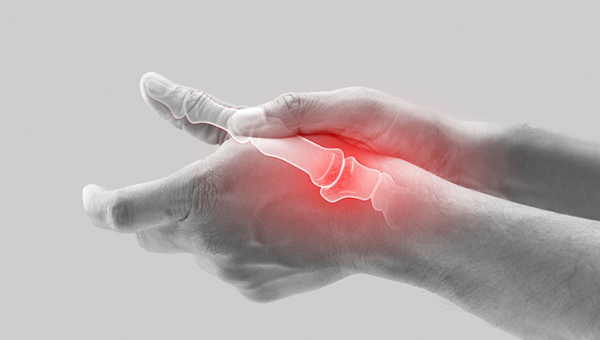 Romatoid Artrit (İltihaplı Romatizma)